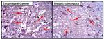 AKT2 Antibody in Immunohistochemistry (Paraffin) (IHC (P))