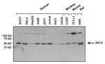 AKT2 Antibody in Western Blot (WB)