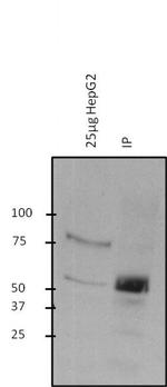 O-linked N-acetylglucosamine (O-GlcNAc) Antibody in Immunoprecipitation (IP)