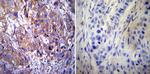 Clathrin Heavy Chain Antibody in Immunohistochemistry (Paraffin) (IHC (P))