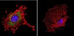 Dynein Antibody in Immunocytochemistry (ICC/IF)