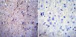 NUP62 Antibody in Immunohistochemistry (Paraffin) (IHC (P))