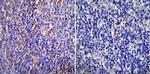 NUP62 Antibody in Immunohistochemistry (Paraffin) (IHC (P))