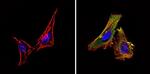 eIF2b gamma Antibody in Immunocytochemistry (ICC/IF)