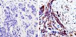 MEK1 Antibody in Immunohistochemistry (Paraffin) (IHC (P))