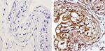 MEK1 Antibody in Immunohistochemistry (Paraffin) (IHC (P))