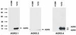 AGR3 Antibody in Western Blot (WB)