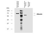 Human Serum Albumin Antibody in Western Blot (WB)