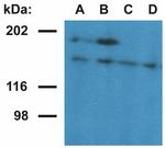 Ubinuclein 1 Antibody in Western Blot (WB)