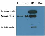 Vimentin Antibody in Immunoprecipitation (IP)