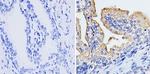 RhoA/RhoC Antibody in Immunohistochemistry (Paraffin) (IHC (P))