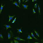 rRNA Antibody in Immunocytochemistry (ICC/IF)