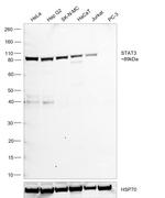 STAT3 Antibody in Western Blot (WB)