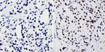 BCR-ABL Antibody in Immunohistochemistry (Paraffin) (IHC (P))