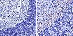 Cyclin A2 Antibody in Immunohistochemistry (Paraffin) (IHC (P))