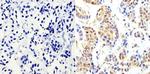 Cyclin B1 Antibody in Immunohistochemistry (Paraffin) (IHC (P))