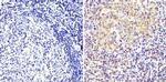 Cyclin B1 Antibody in Immunohistochemistry (Paraffin) (IHC (P))