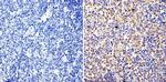 Cyclin B1 Antibody in Immunohistochemistry (Paraffin) (IHC (P))