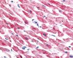 HIF-2 alpha Antibody in Immunohistochemistry (Paraffin) (IHC (P))