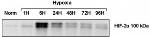 HIF-2 alpha Antibody in Western Blot (WB)