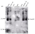 FANCD2 Antibody in Western Blot (WB)