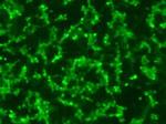 RPE65 Antibody in Immunocytochemistry (ICC/IF)