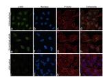 p300 Antibody in Immunocytochemistry (ICC/IF)