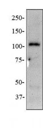 NOD2 Antibody in Western Blot (WB)