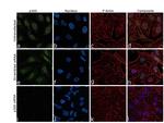 p300 Antibody