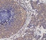 MMP2 Antibody in Immunohistochemistry (Paraffin) (IHC (P))