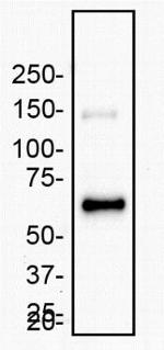 MMP2 Antibody in Western Blot (WB)