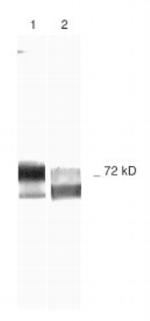 MMP2 Antibody in Western Blot (WB)