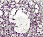 MMP2 Antibody in Immunohistochemistry (Paraffin) (IHC (P))