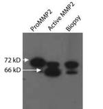 MMP2 Antibody in Western Blot (WB)