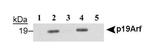 p19ARF Antibody in Western Blot (WB)