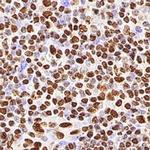 hnRNP M1-M4 Antibody in Immunohistochemistry (Paraffin) (IHC (P))