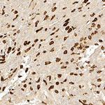 Bestrophin 1 Antibody in Immunohistochemistry (Paraffin) (IHC (P))