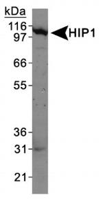 HIP1 Antibody in Western Blot (WB)