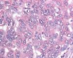 Survivin Antibody in Immunohistochemistry (Paraffin) (IHC (P))