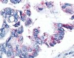 Survivin Antibody in Immunohistochemistry (Paraffin) (IHC (P))