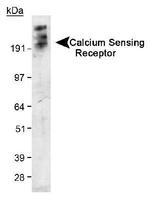 Calcium Sensing Receptor Antibody in Western Blot (WB)