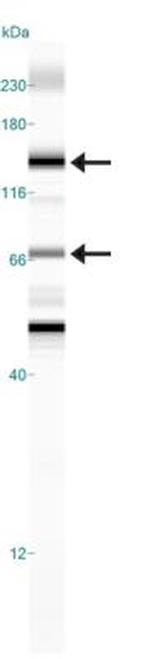 Calcium Sensing Receptor Antibody in Western Blot (WB)