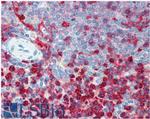 CD18 Antibody in Immunohistochemistry (Paraffin) (IHC (P))