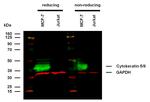 Cytokeratin 5/8 Antibody in Western Blot (WB)