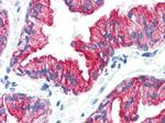 Cytokeratin 8 Antibody in Immunohistochemistry (Paraffin) (IHC (P))