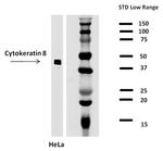 Cytokeratin 8 Antibody in Western Blot (WB)