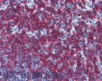 CD45RB Antibody in Immunohistochemistry (Paraffin) (IHC (P))