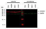 beta Tubulin Antibody in Western Blot (WB)