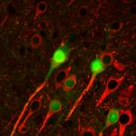 beta-3 Tubulin Antibody in Immunohistochemistry (Paraffin) (IHC (P))