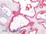 PSA Antibody in Immunohistochemistry (Paraffin) (IHC (P))